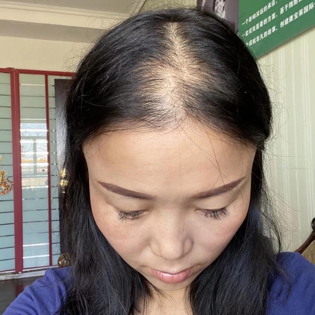 叶子养头发