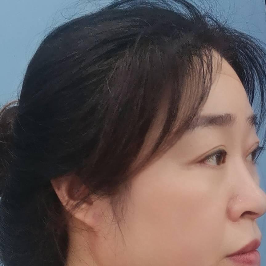 农村单亲妈妈