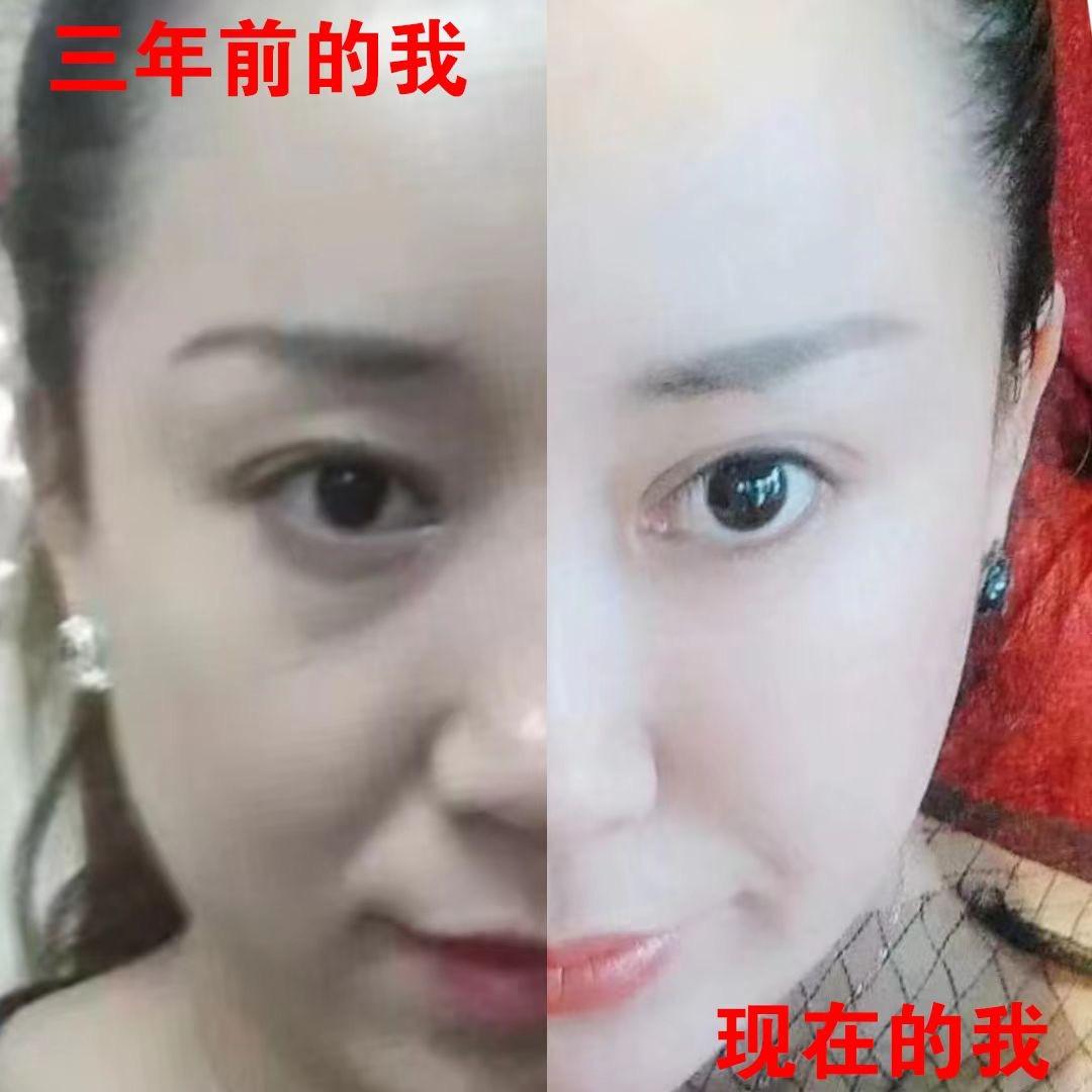 多米面部瑜伽（眼袋，泪沟，法令纹）