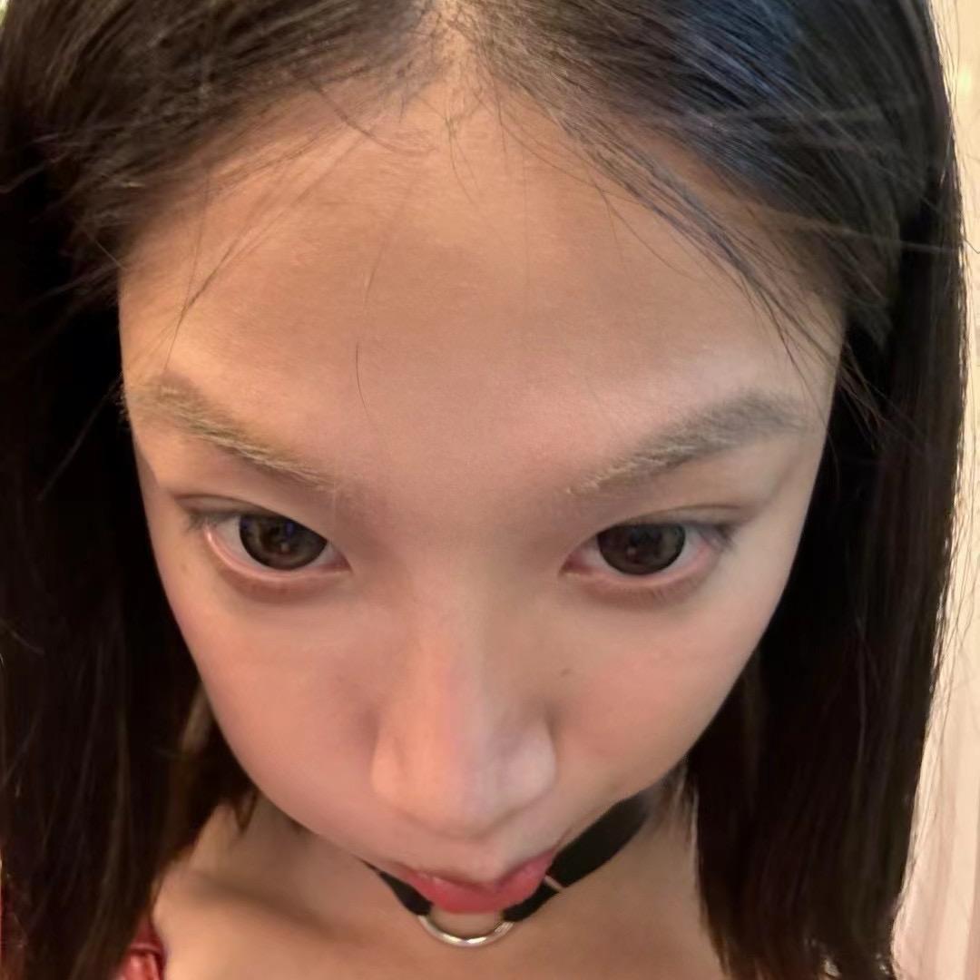 禿頭拉麵