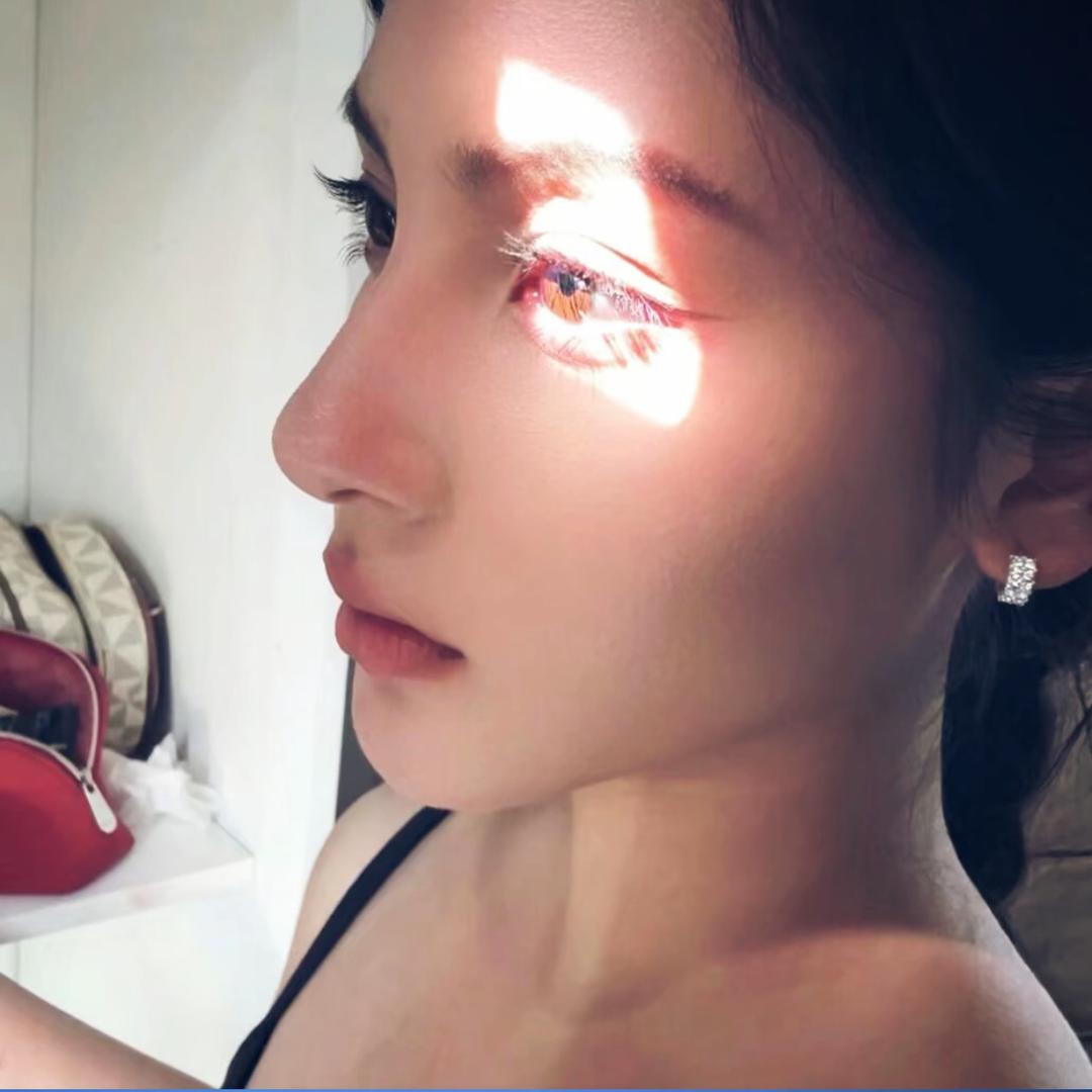 玲