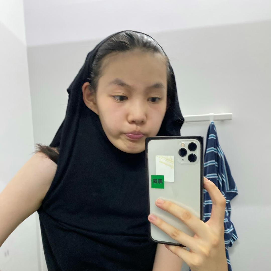 撑掉大牙了