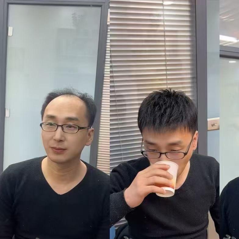 假发哥