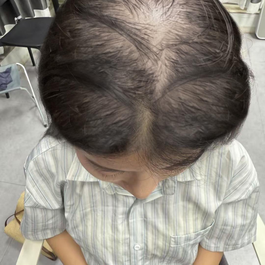 华渼芭西养发达人