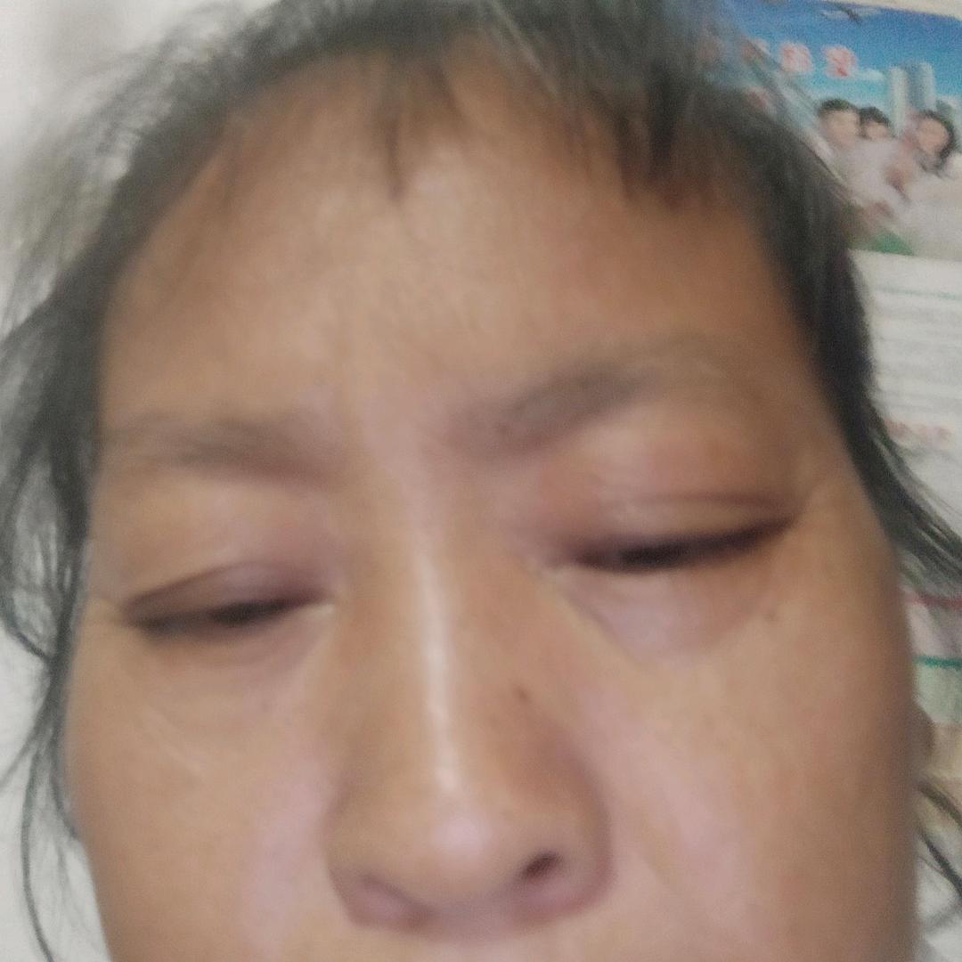 莲
