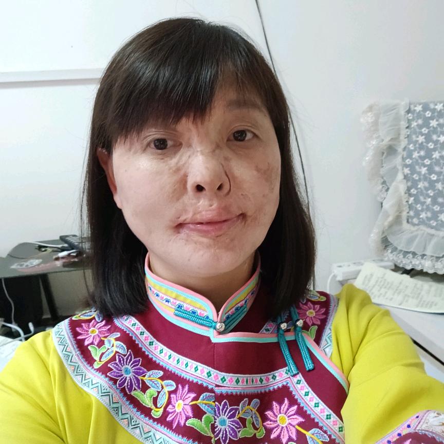 阳光梅子