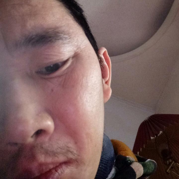 尿多症患者8年
