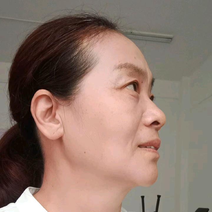 小宇