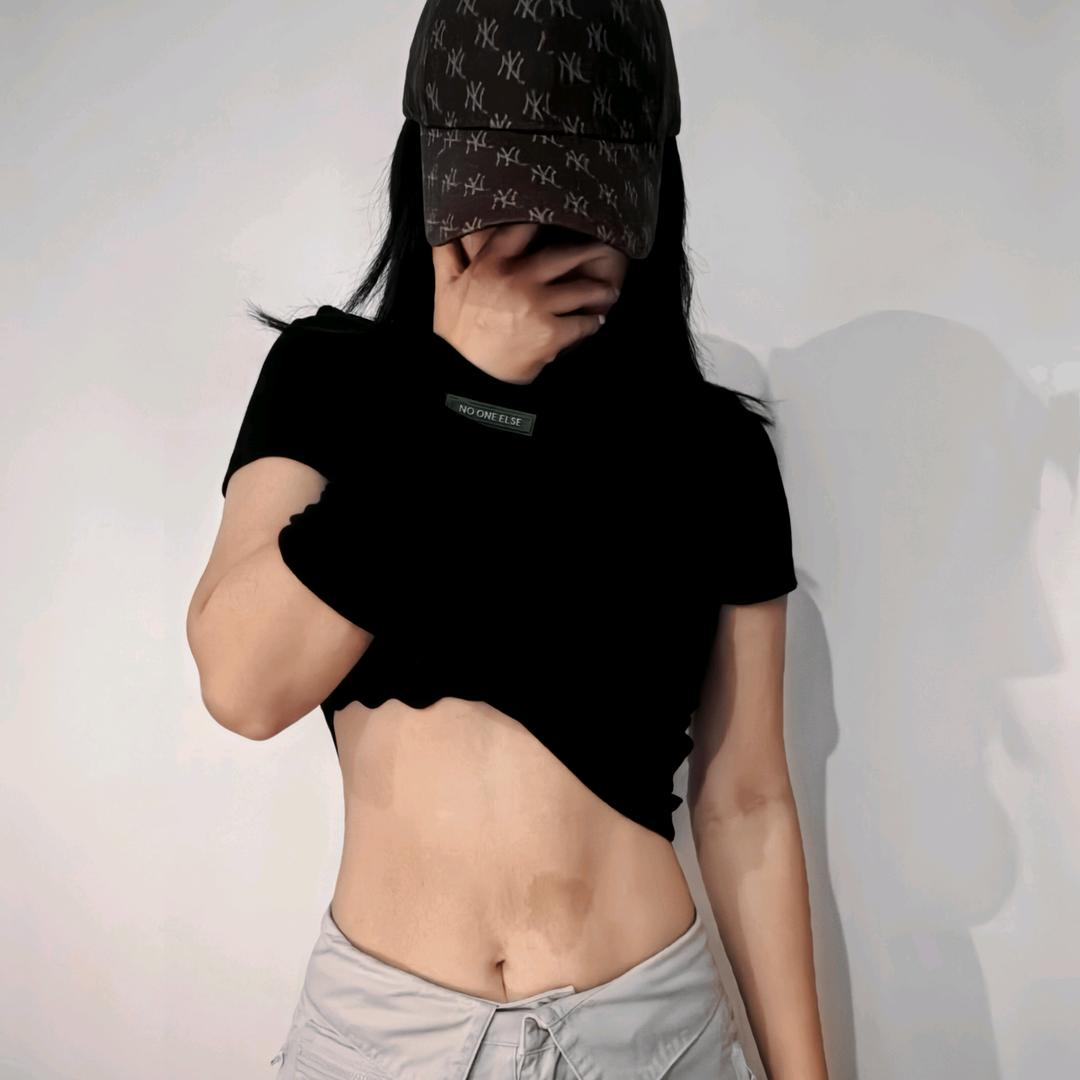 樱桃🍒