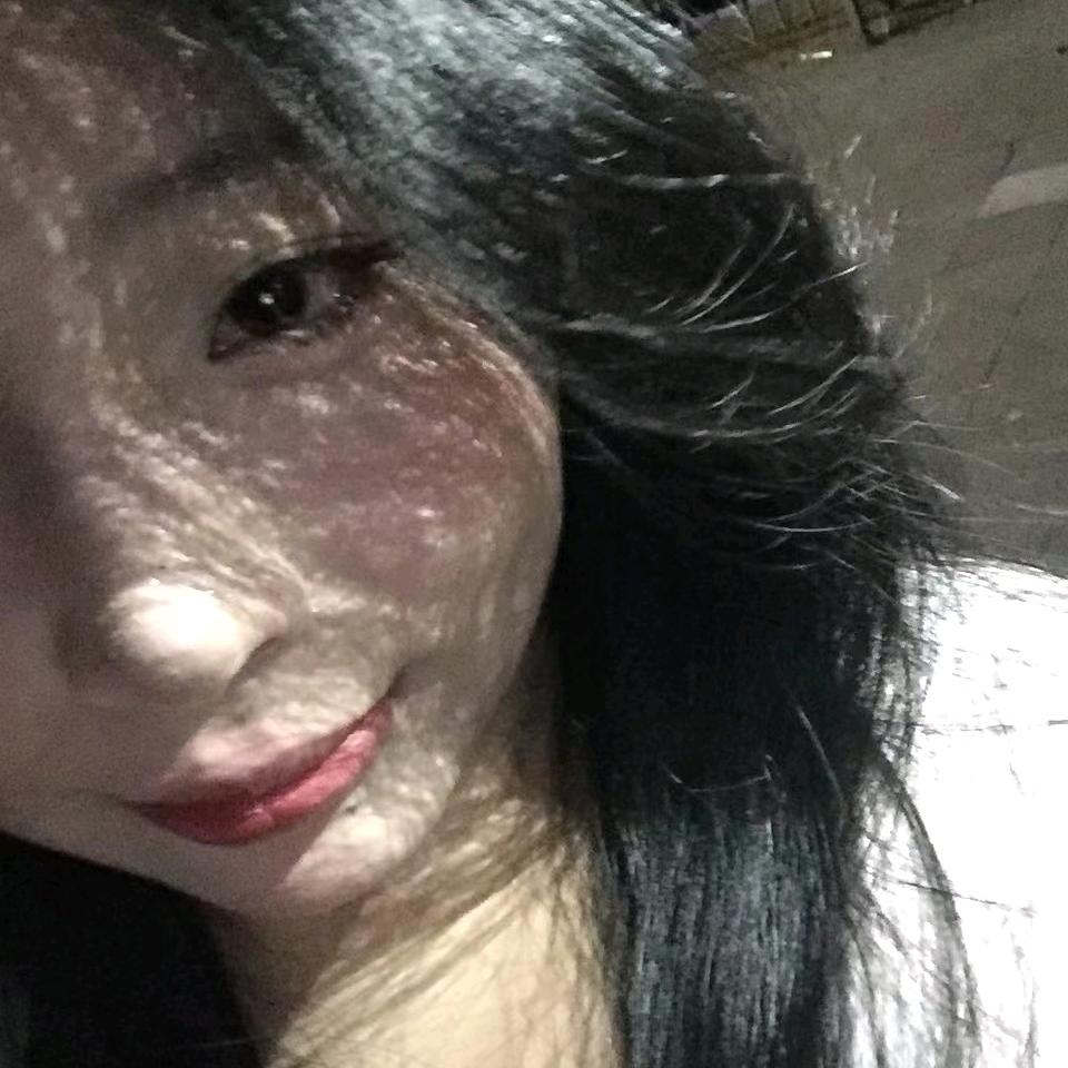 Xy.