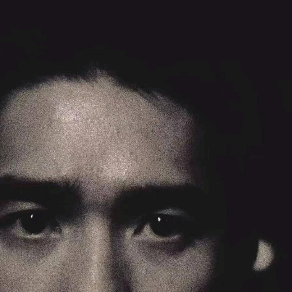 臭小屁