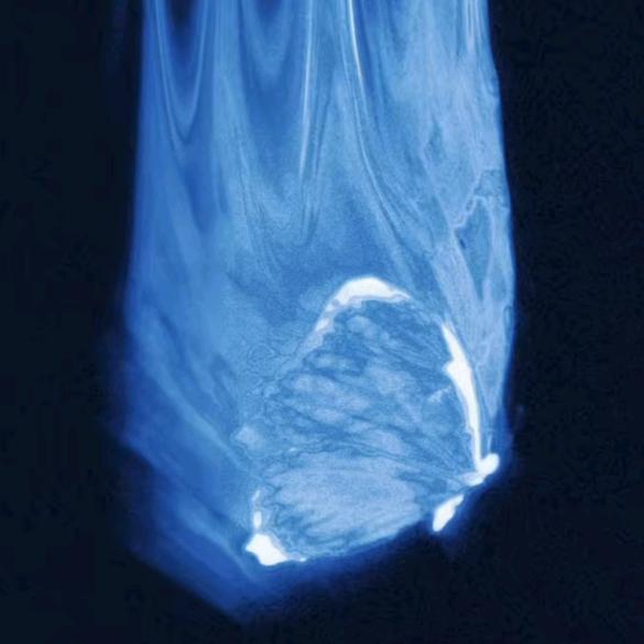 Jintian早点睡