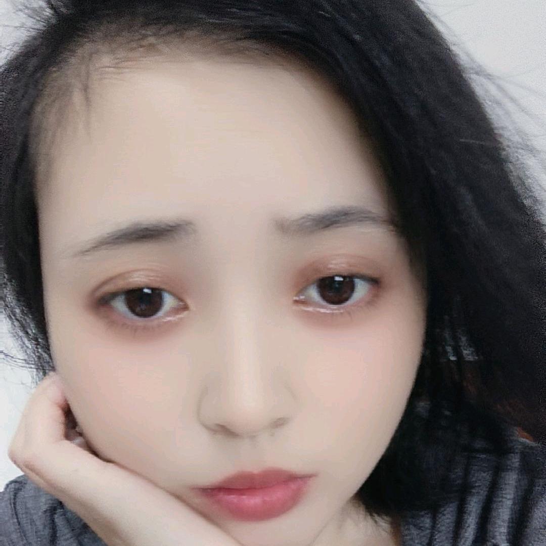 浩浩妈妈《自免肝肝移植恢复中》